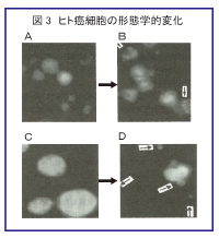 ヒト癌細胞の形態学的変化